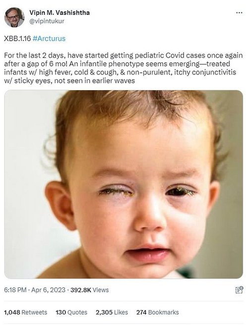 Typically Covid symptoms are known to include a high fever, cough, cold and loss of the sense of taste or smell. But Vipin Vashishtha, consultant paediatrician at the Mangla Hospital and Research Centre and former official at the Indian Academy of Paediatrics, revealed earlier this month that symptoms affecting children's eyes have seen a sudden surge. He said he is now seeing a rise in cases involving 'itchy' conjunctivitis or 'sticky eyes', a symptom he had not witnessed during earlier Covid waves