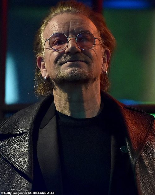 The 62-year-old revealed that he wears the shades to alleviate the difficulties