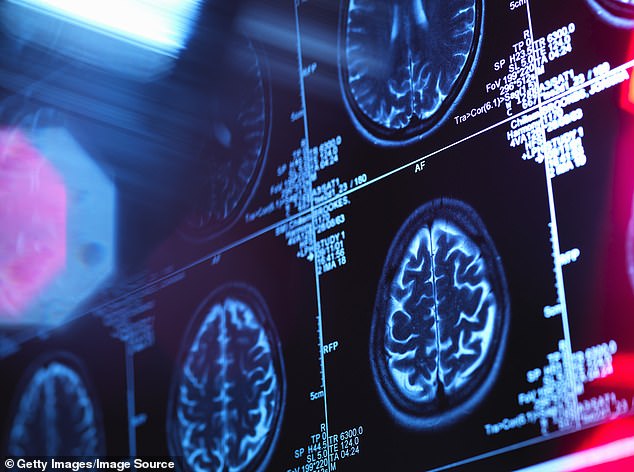 I'm going to explain what is really going on behind the latest health news stories - starting with ¿potentially falsified¿ data that lies at the heart of dementia research