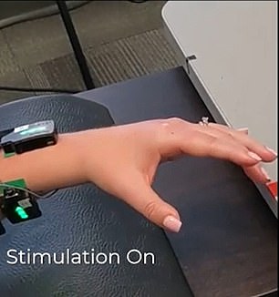 Electrical stimulation of the spinal cord has helped one woman, Heather Rendulic, eat with a knife and fork for the first time in almost a decade