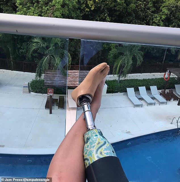 She has had several different prosthetics since losing her right leg below the knee