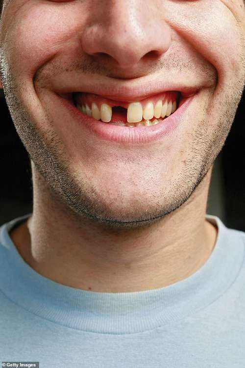 Toothpaste contains fluoride which ¿has been extensively researched in terms of how it strengthens tooth enamel ¿ the hard outer covering on teeth ¿ and reverses tooth decay'