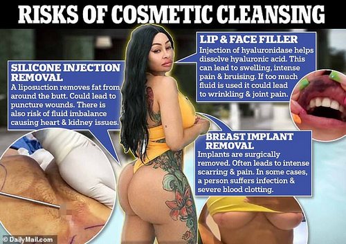 The grim realities of removing lip filler/botox/BBLs