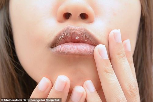 A key question here is whether you have saliva at times — such as would occur if you put a sliver of lemon in your mouth — or do you have a constant dry mouth? (file image)