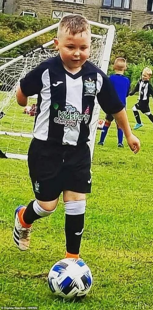 Charity champion James Anderson, 55, from Burnley, Lancashire offered to pay nearly £13,000 do that Alex Sparkes, pictured, could get the bionic arm he has been dreaming about