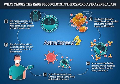 In a very small number of cases — about one in 100,000 in the UK — the vaccine can set off a chain reaction which leads to the body confusing its own blood platelets for fragments of virus. The shell of the vector vaccine — the weakened cold virus used to teach cells how to neutralise Covid — sometimes acts like a magnet and attracts platelets, a protein found in the blood. For reasons the scientists are still probing, the body then mistakes these clumps as a threat and produces antibodies to fight them. The combination of the platelets and the antibodies clumping together leads to the formation of dangerous blood clots
