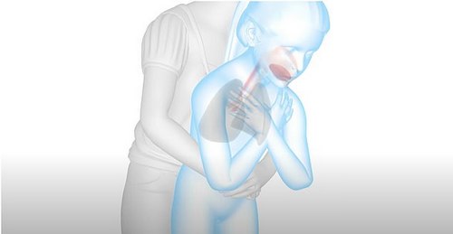 Pictured above is an adult trying the Heimlich maneuver on a child who was choking