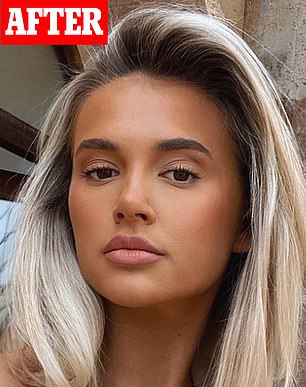 She said felt 'blessed' she had been able to 'fix' the excessive amount of filler she put into her face (pictured in 2022)