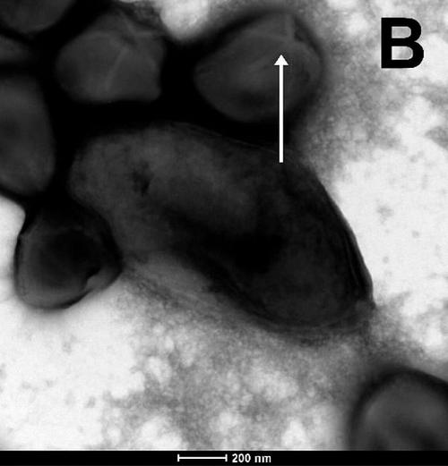 Both the Pandoravirus mammoth and Megavirus mammoth were discovered in 27,000-year-old clump of ice and frozen mammoth wool on the banks of the Yana river in Russia. Like past ancient giant viruses, both have been shown to be capable of killing amoebas