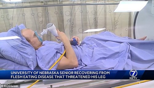 Mr Robb has had to sit in a chamber for two and a half hours per day during his recovery that exposes the body to extra oxygen. Scientists say this can speed the recovery of cells