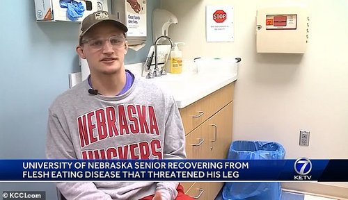 The wrestler was left in 'excruciating' pain after the third surgery with holes on both sides of his shin bone